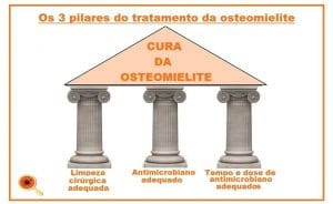 Osteomielite: Saiba Mais Sobre Ela - Dra. Keilla Freitas Infectologista Osteomielite: Saiba Mais Sobre esta Infecção - Dra. Keilla Freitas Infectologista