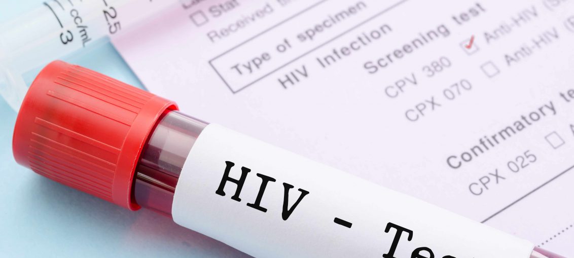 sintomas de infecção recente pelo HIV