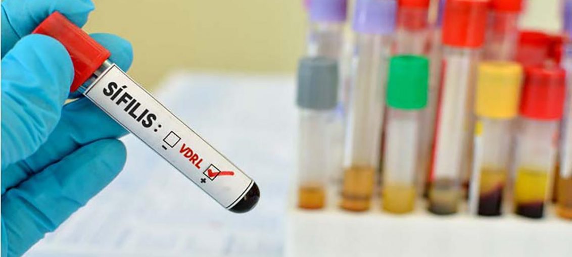 Infectologista - Teste falso positivo em sífilis: Veja alguns motivos Infectologista - Teste falso positivo em sífilis: Veja alguns motivos