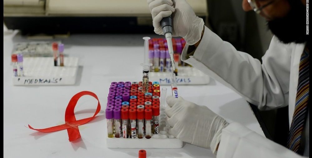 Infectologista - Anticorpos contra o HIV matam 98% dos casos Infectologista - Anticorpos contra o HIV matam 98% dos casos