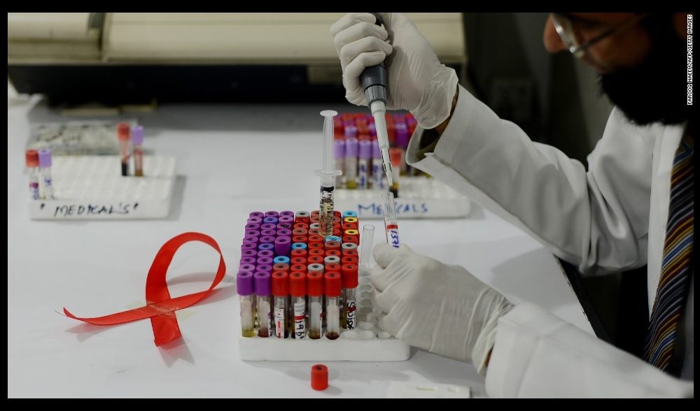 Anticorpos contra o HIV matam 98% dos casos