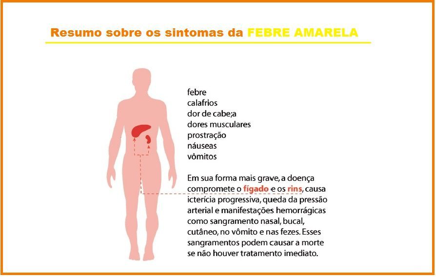 Febre Amarela