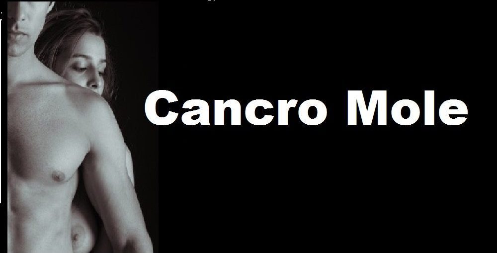 Infectologista - Cancro mole ou Cancroide: Conheça Infectologista - Cancro mole ou Cancroide: Conheça