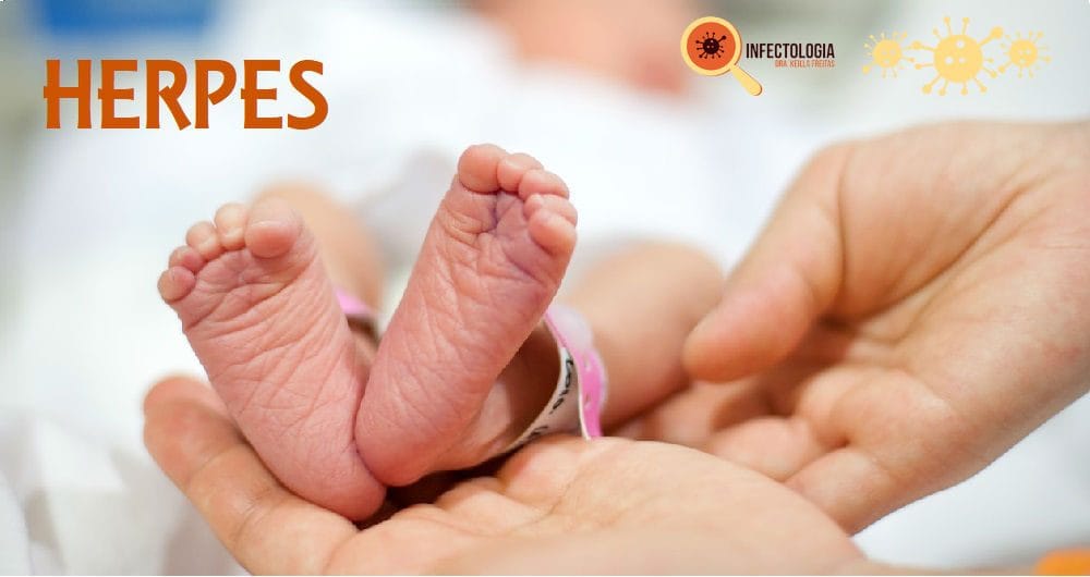 Herpes Gestacional E Herpes Neonatal Por Levar A Serios Problemas Herpes Gestacional E Herpes Neonatal Por Levar A Serios Problemas