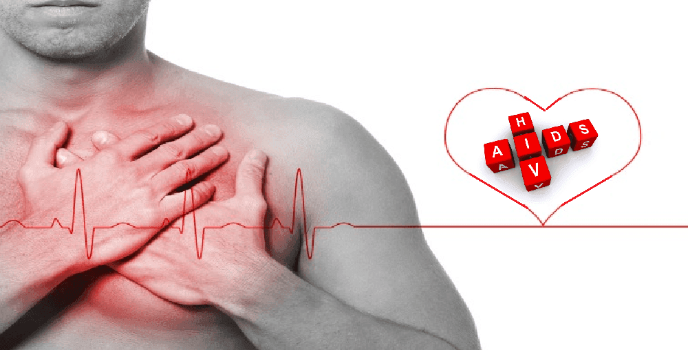 HIV aumenta risco de doenças cardiovasculares