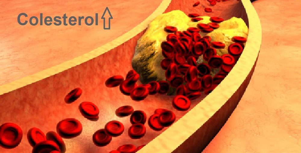 Novo medicamento para Tratamento do colesterol em pacientes HIV
