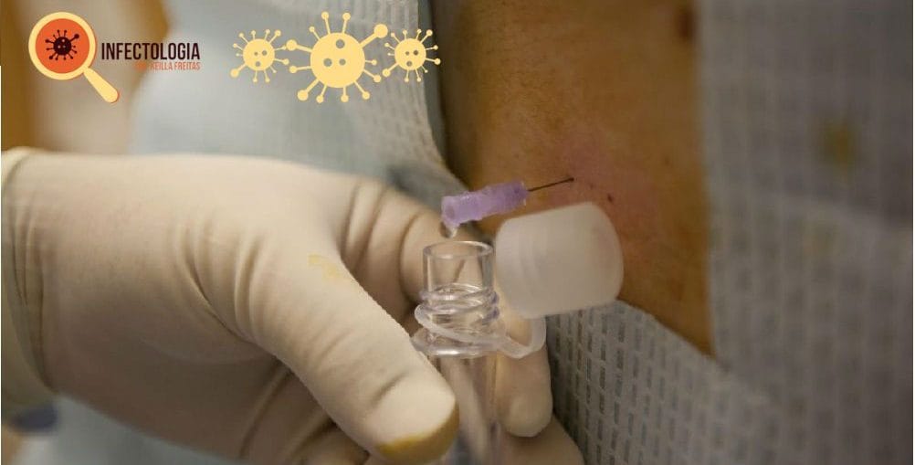 Infectologista - O que é exame de liquor? Infectologista - O que é exame de liquor?