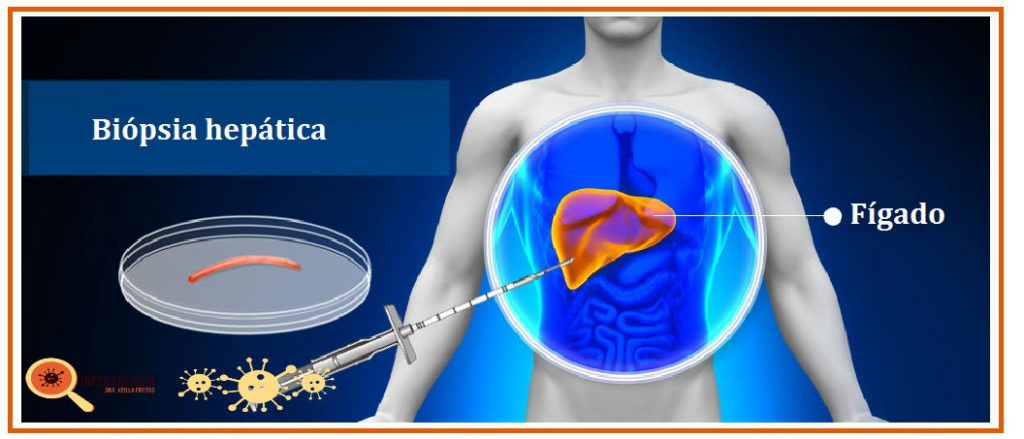 Hepatite B: o que você precisa saber