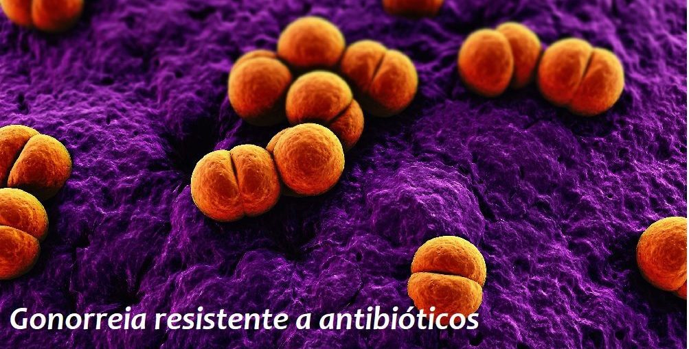 Infectologista - Resistência de gonococo no Rio de Janeiro Infectologista - Resistência de gonococo no Rio de Janeiro