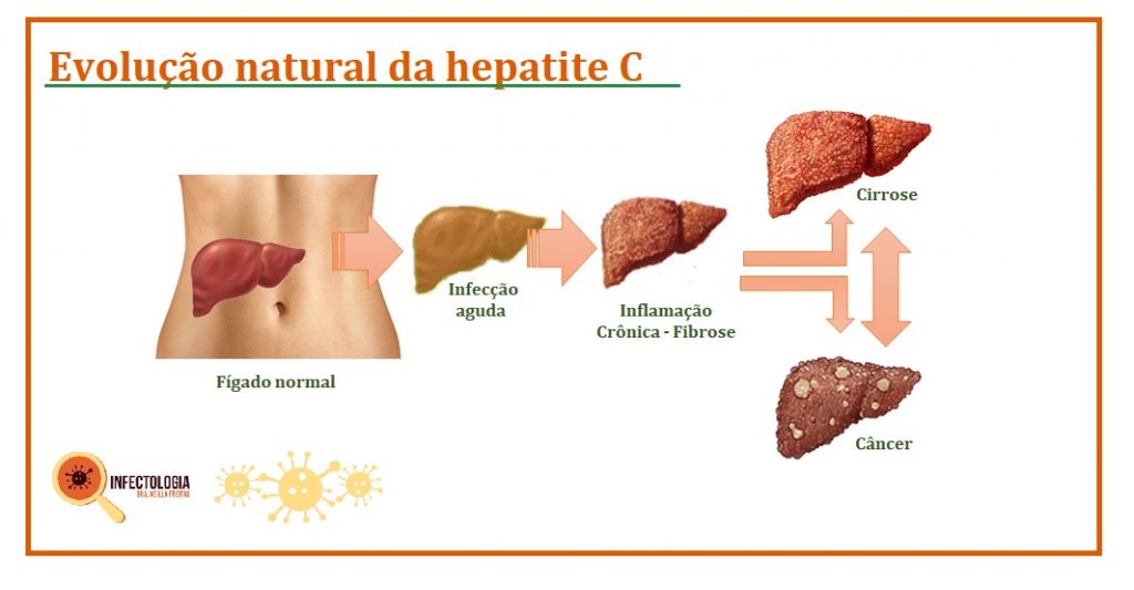 Animando-C: Anti HCV positivo não significa hepatite C crônica