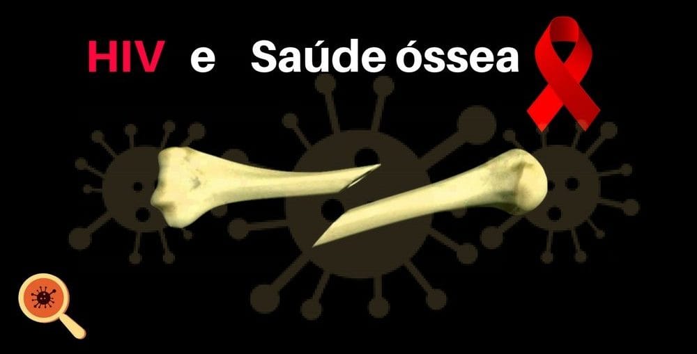 Infectologista - Efeitos do HIV nos ossos Infectologista - Efeitos do HIV nos ossos