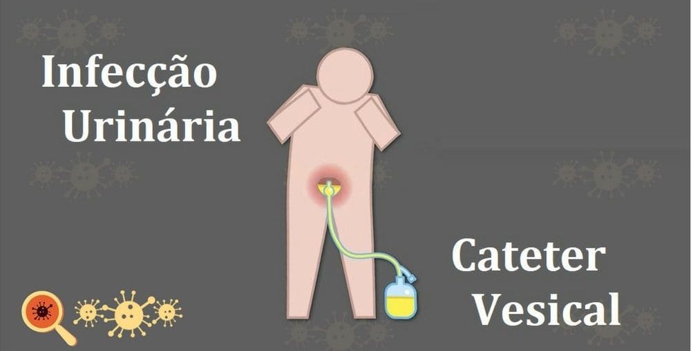 Infecção urinária associada a sonda vesical