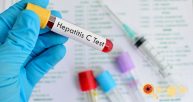 Hepatite C – Diagnóstico