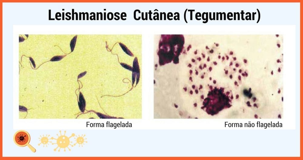 Leishmaniose Cutânea