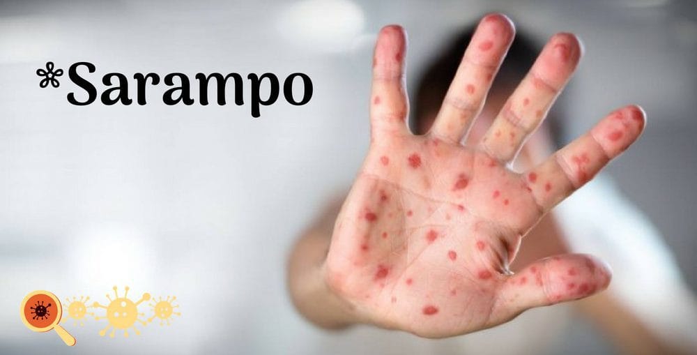 Sarampo Capa Saiba Mais