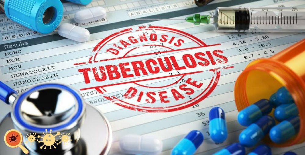 A Tuberculose é uma doença infecciosa ainda muito prevalente no mundo.