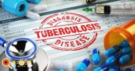 diagnóstico da tuberculose