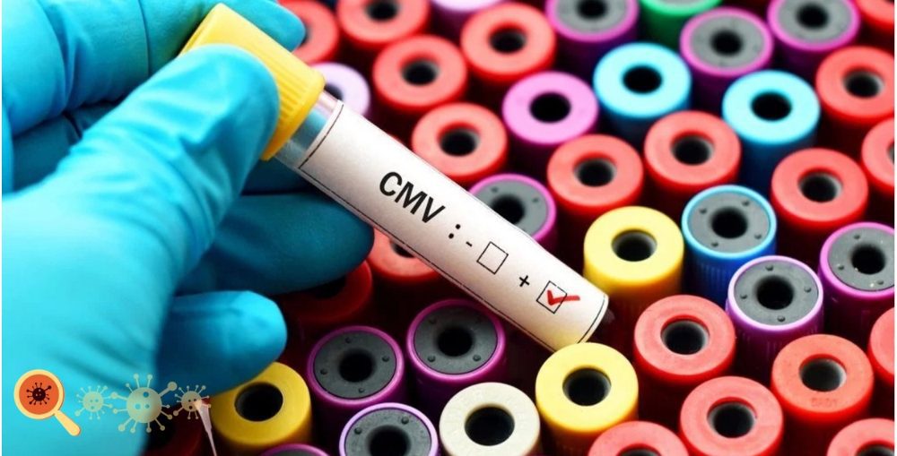 Infectologista - Conheça mais sobre o Citomegalovírus ou CMV Infectologista - Conheça mais sobre o Citomegalovírus ou CMV