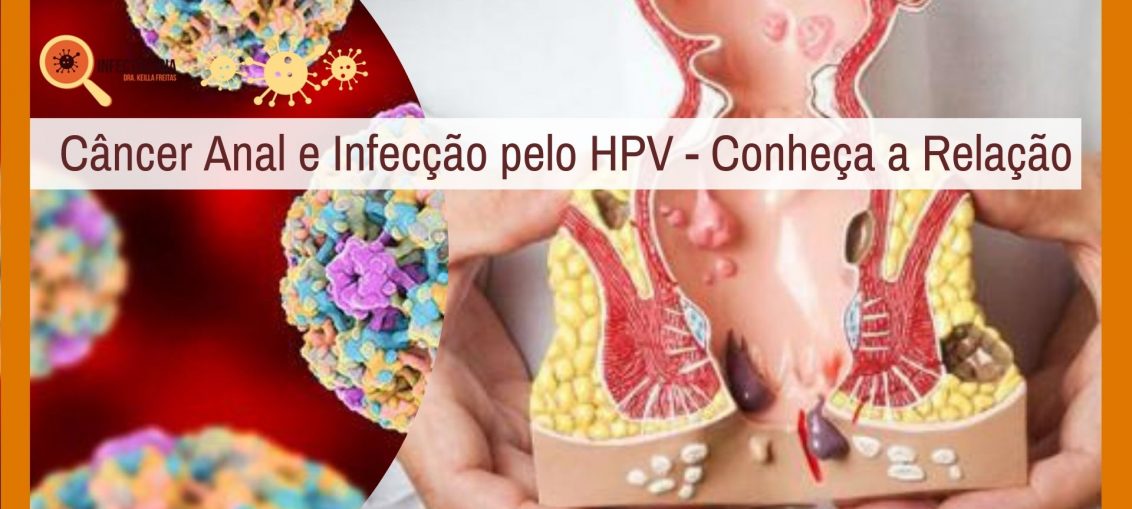 Infectologista - Câncer Anal e Infecção pelo HPV – Conheça a Relação Infectologista - Câncer Anal e Infecção pelo HPV – Conheça a Relação