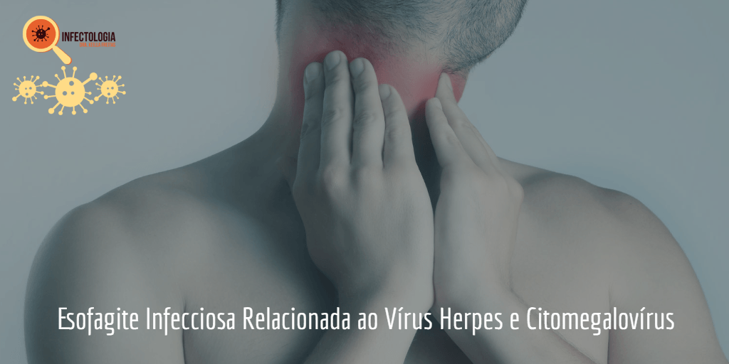 Esofagite Infecciosa Relacionada ao Vírus Herpes e Citomegalovírus
