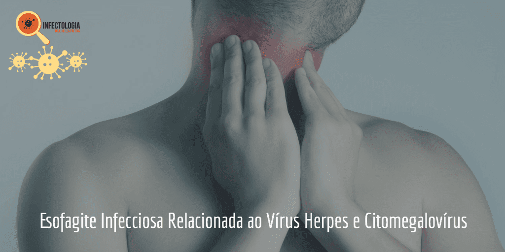 esofagite infecciosa relacionada ao virus herpes e citomegalovirus