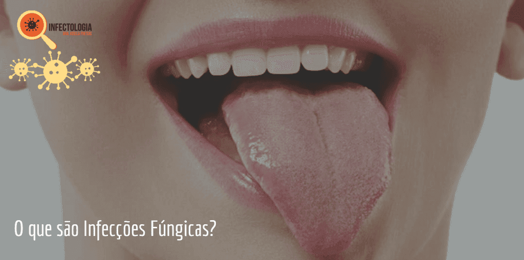 Infectologista - O que são Infecções Fúngicas? Infectologista - O que são Infecções Fúngicas?