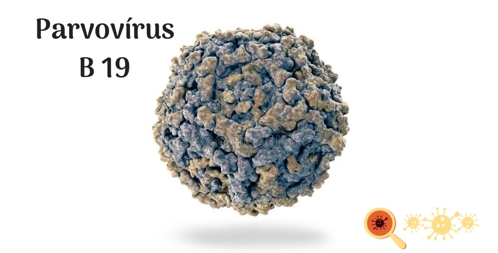 Infectologista - Parvovírus B 19 Infectologista - Parvovírus B 19