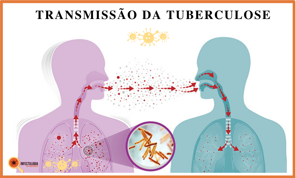 Tuberculose: Saiba mais