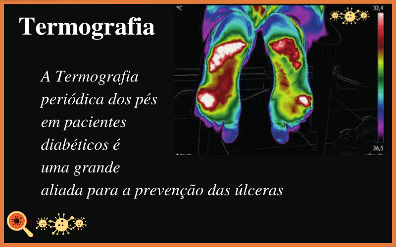 Pé diabético: Conheça