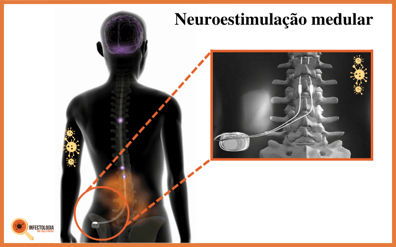 Pé diabético: Conheça